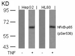 RelA/NFkB p65, p Ser536 Antibody, Novus Biologicals 25 &mu;L; Unconjugated:Antibodies,